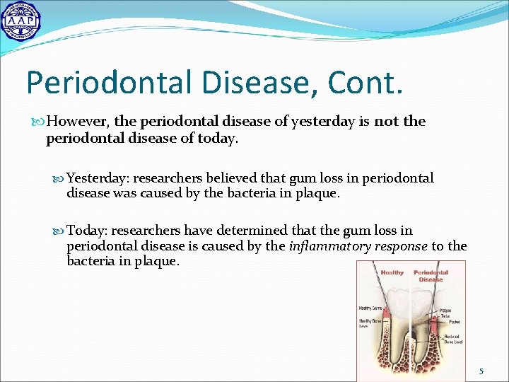 Periodontal Disease, Cont. However, the periodontal disease of yesterday is not the periodontal disease