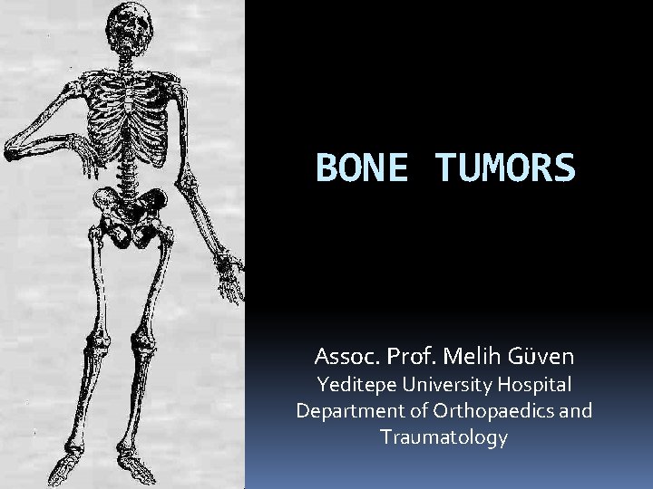 BONE TUMORS Assoc. Prof. Melih Güven Yeditepe University Hospital Department of Orthopaedics and Traumatology