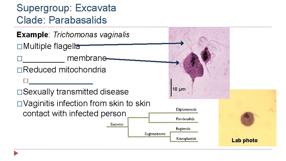 Supergroup: Excavata Clade: Parabasalids Example: Trichomonas vaginalis �Multiple flagella �_____ membrane �Reduced mitochondria �