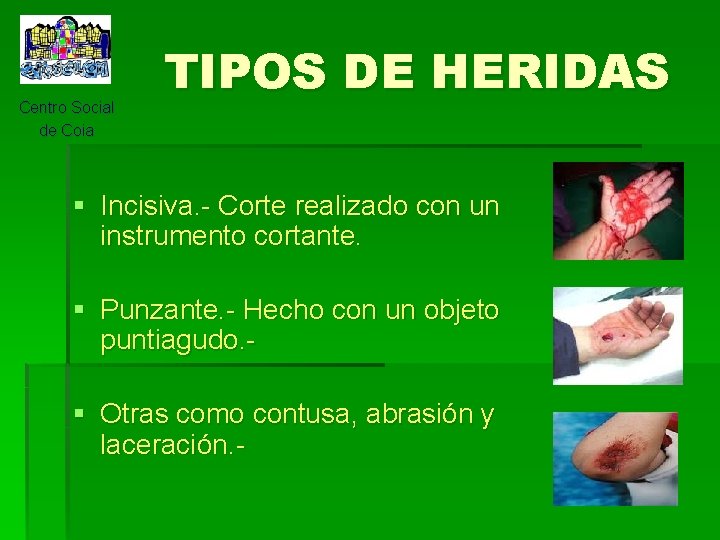 Centro Social de Coia TIPOS DE HERIDAS § Incisiva. - Corte realizado con un