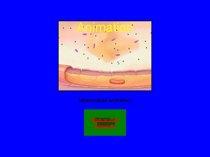 Animation Inflammation animation. Click to view animation. 