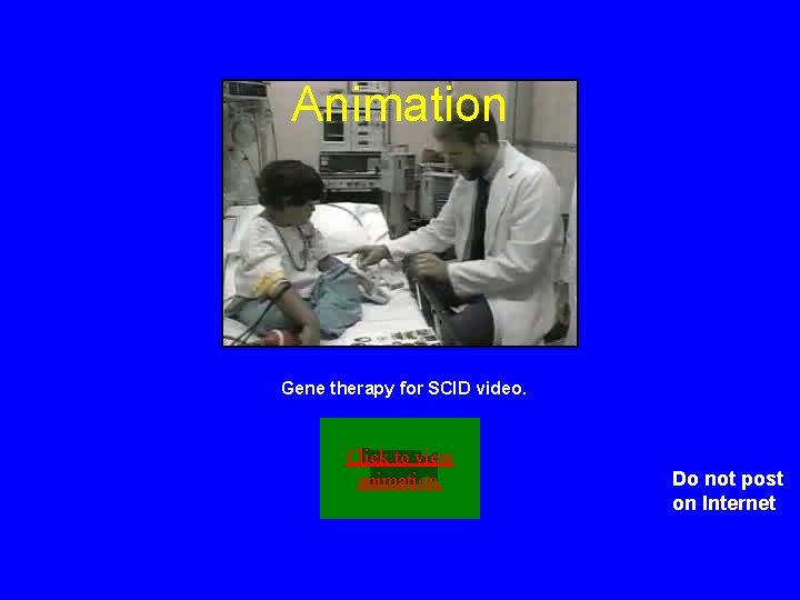 Animation Gene therapy for SCID video. Click to view animation. Do not post on