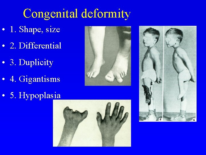 Congenital deformity • 1. Shape, size • 2. Differential • 3. Duplicity • 4.