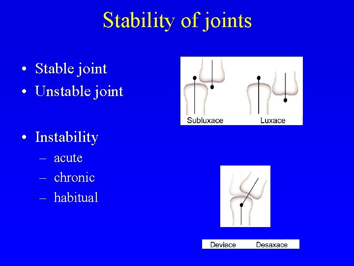 Stability of joints • Stable joint • Unstable joint • Instability – acute –