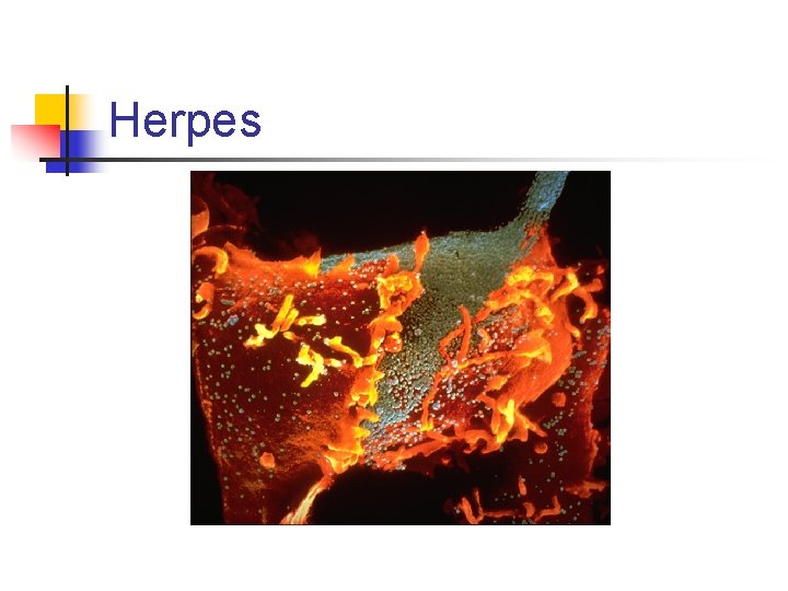 Herpes 