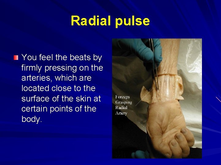 Radial pulse You feel the beats by firmly pressing on the arteries, which are