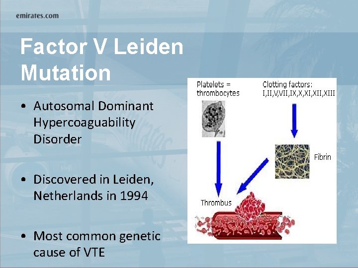 Factor V Leiden Mutation • Autosomal Dominant Hypercoaguability Disorder • Discovered in Leiden, Netherlands