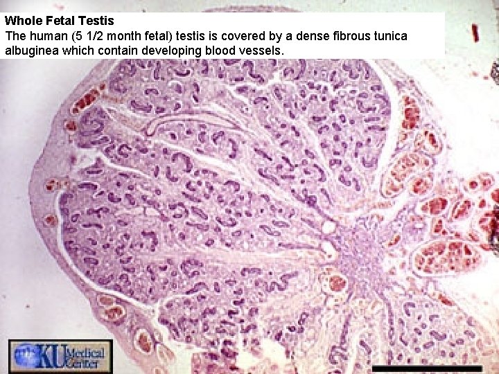 Whole Fetal Testis The human (5 1/2 month fetal) testis is covered by a