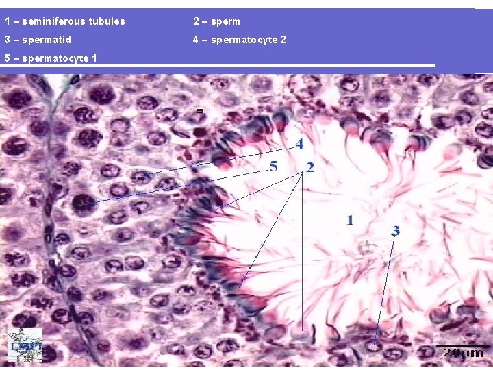 1 – seminiferous tubules 2 – sperm 3 – spermatid 4 – spermatocyte 2
