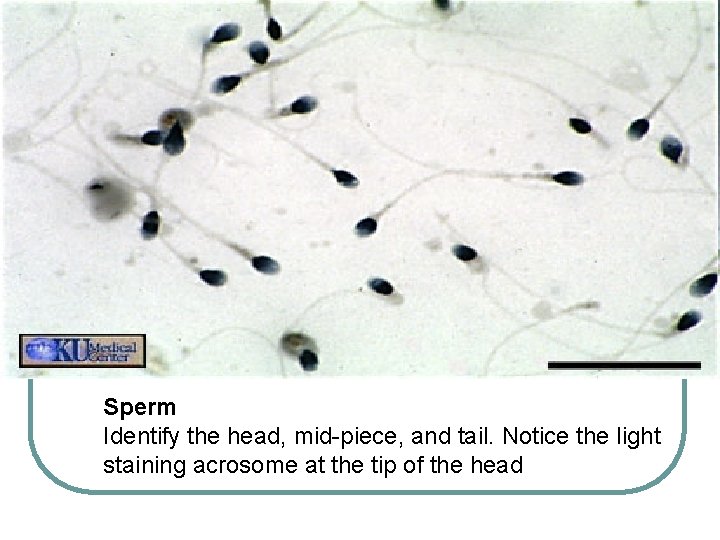 Sperm Identify the head, mid-piece, and tail. Notice the light staining acrosome at the