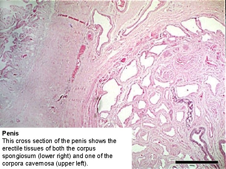Penis This cross section of the penis shows the erectile tissues of both the