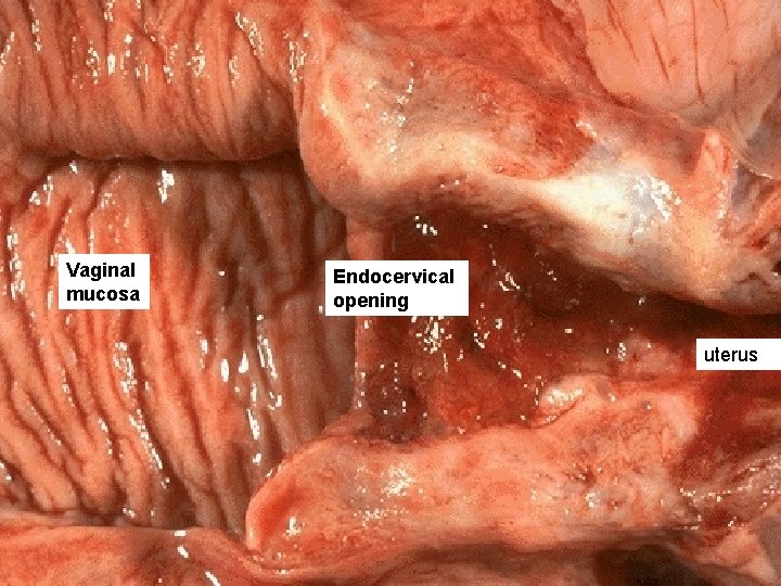 Vaginal mucosa Endocervical opening uterus 