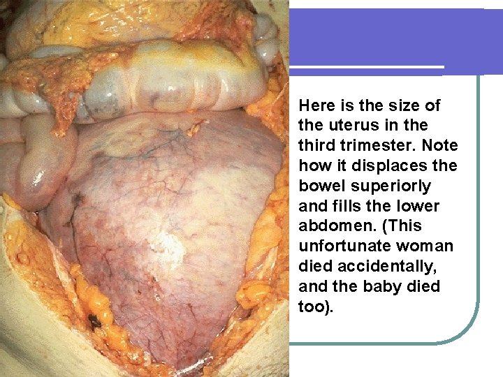 Here is the size of the uterus in the third trimester. Note how it