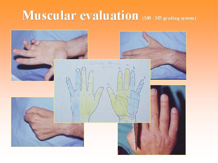 Muscular evaluation (M 0 - M 5 grading system) 