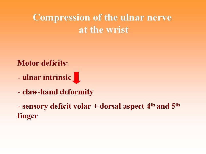 Compression of the ulnar nerve at the wrist Motor deficits: - ulnar intrinsic -