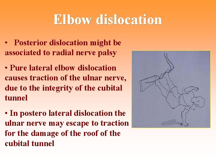 Elbow dislocation • Posterior dislocation might be associated to radial nerve palsy • Pure