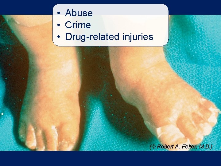  • Abuse • Crime • Drug-related injuries (© Robert A. Felter, M. D.
