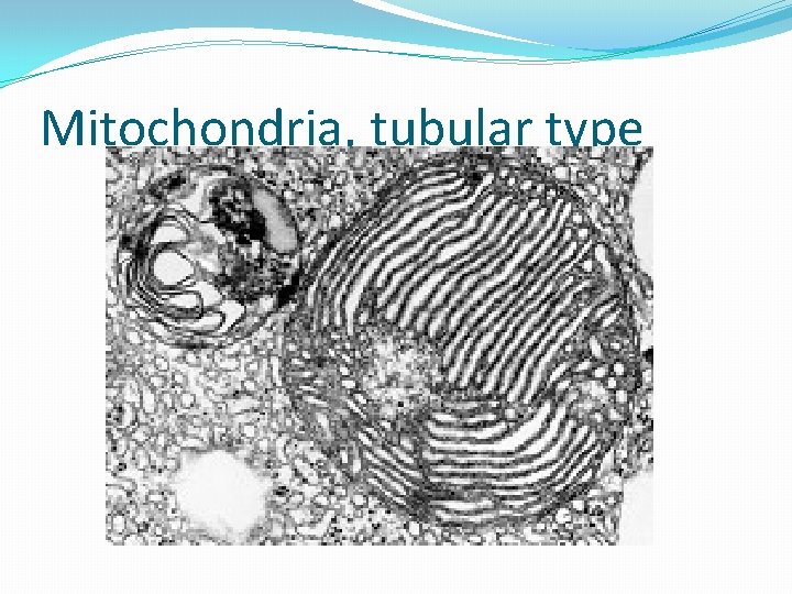 Mitochondria, tubular type 