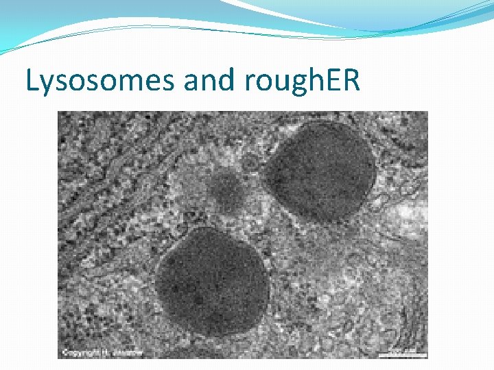 Lysosomes and rough. ER 