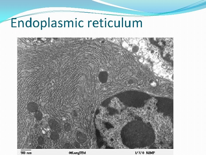 Endoplasmic reticulum 