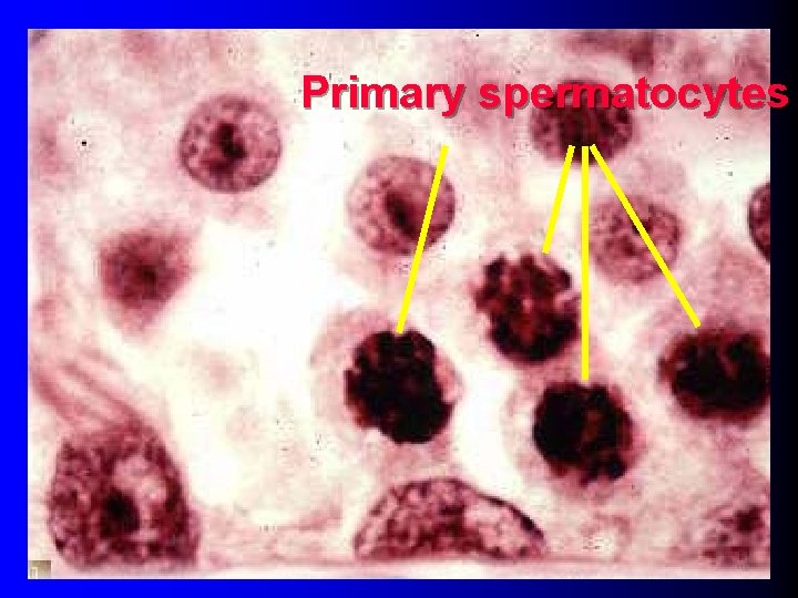 Primary spermatocytes 