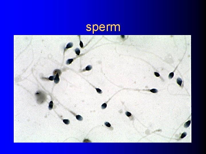 sperm 