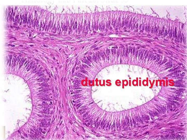 dutus epididymis 