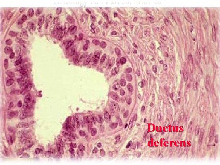 Ductus deferens 