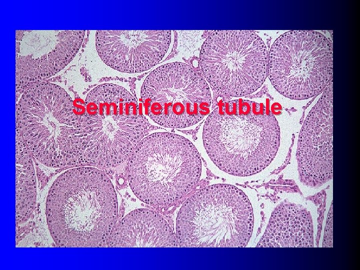 Seminiferous tubule 