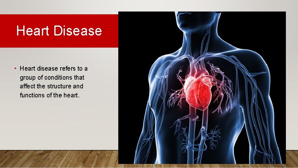 Heart Disease • Heart disease refers to a group of conditions that affect the