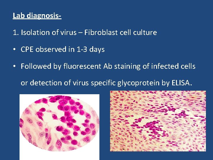 Lab diagnosis 1. Isolation of virus – Fibroblast cell culture • CPE observed in