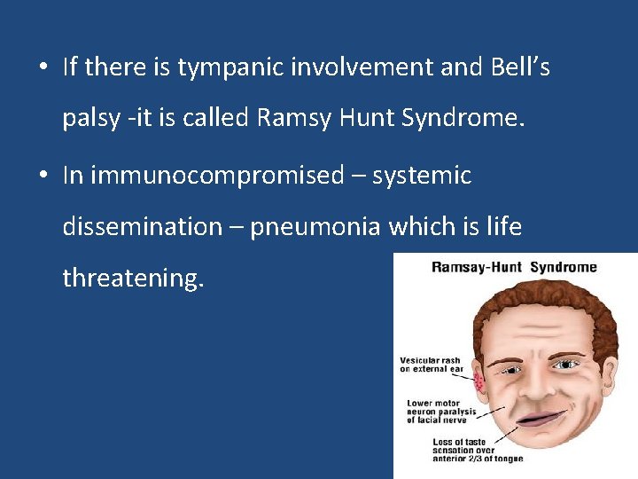  • If there is tympanic involvement and Bell’s palsy -it is called Ramsy