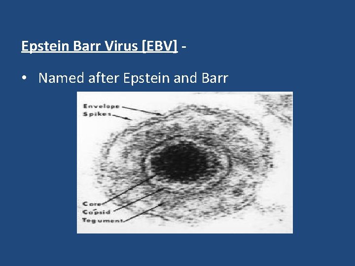 Epstein Barr Virus [EBV] - • Named after Epstein and Barr 