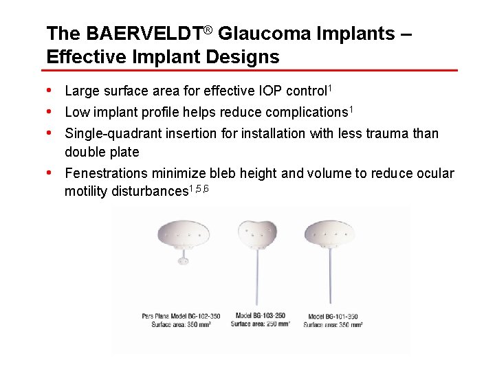 The BAERVELDT® Glaucoma Implants – Effective Implant Designs • Large surface area for effective