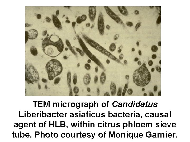 TEM micrograph of Candidatus Liberibacter asiaticus bacteria, causal agent of HLB, within citrus phloem