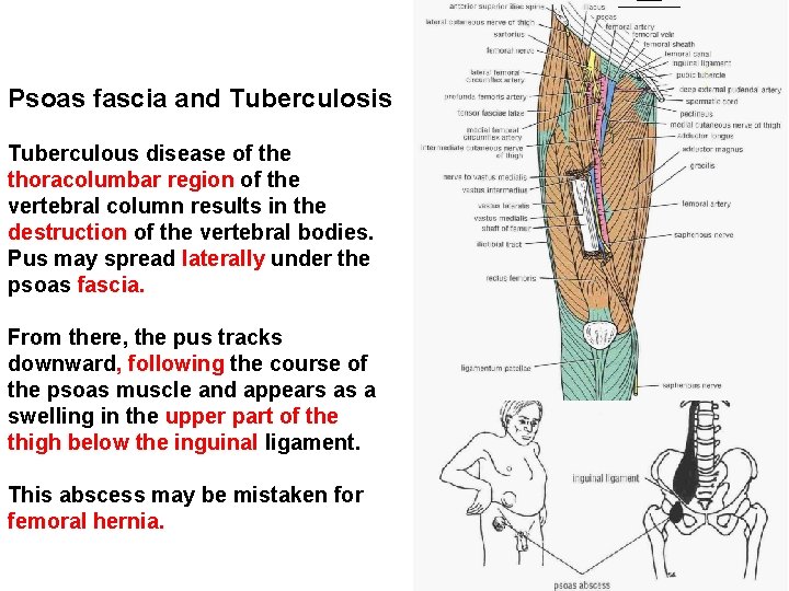 Psoas fascia and Tuberculosis Tuberculous disease of the thoracolumbar region of the vertebral column