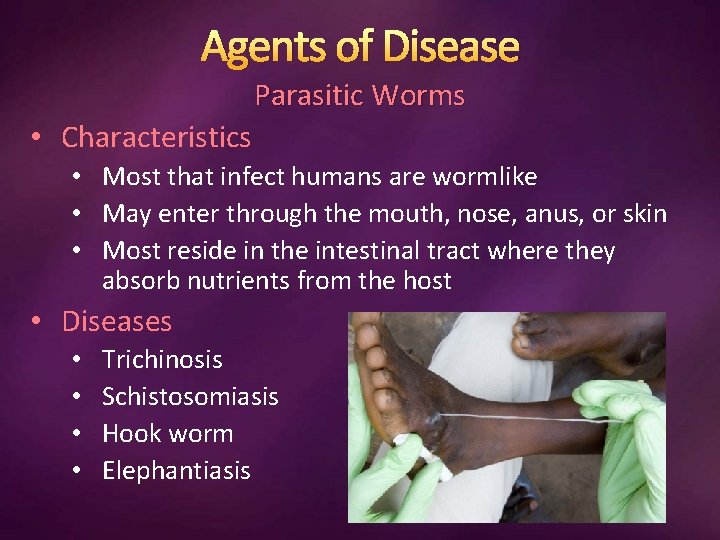 Agents of Disease Parasitic Worms • Characteristics • Most that infect humans are wormlike