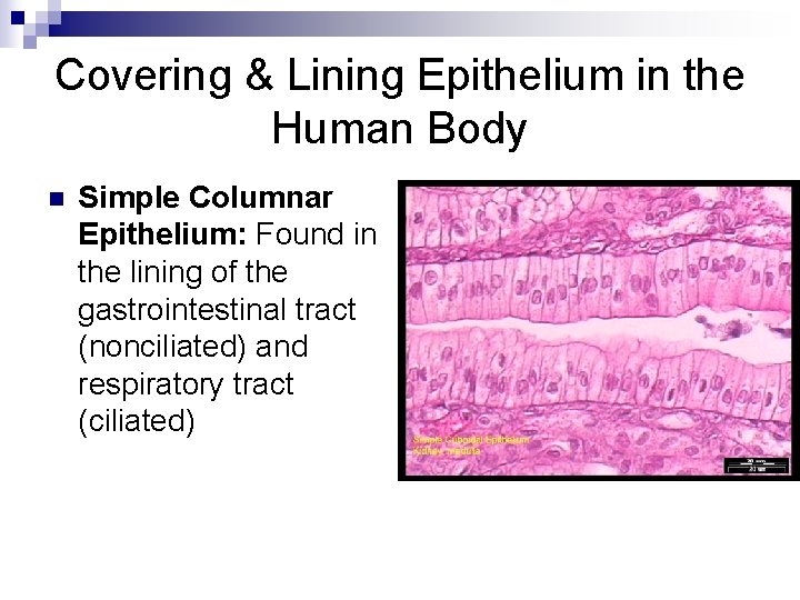 Covering & Lining Epithelium in the Human Body n Simple Columnar Epithelium: Found in