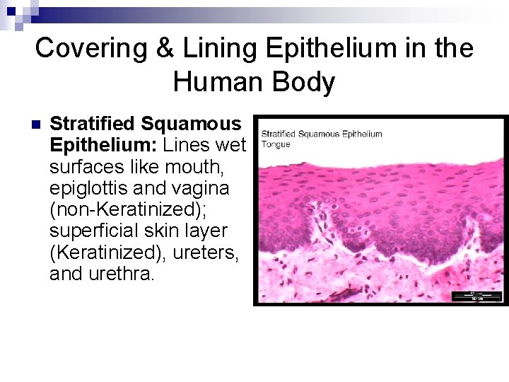 Covering & Lining Epithelium in the Human Body n Stratified Squamous Epithelium: Lines wet