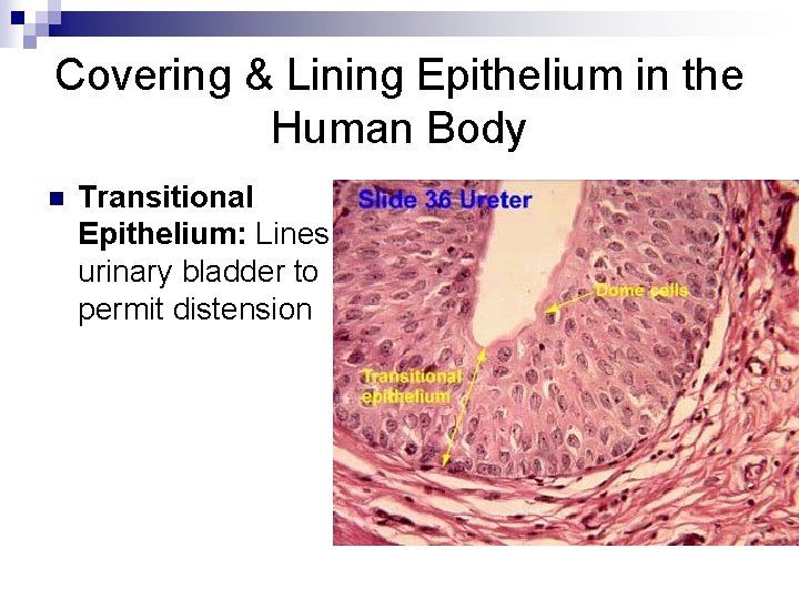 Covering & Lining Epithelium in the Human Body n Transitional Epithelium: Lines urinary bladder