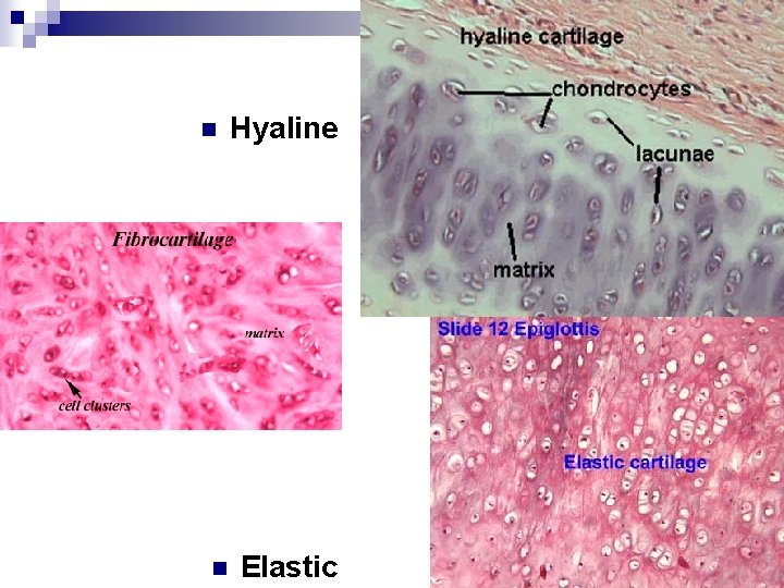 n n Hyaline Fibrocartilage n Elastic 