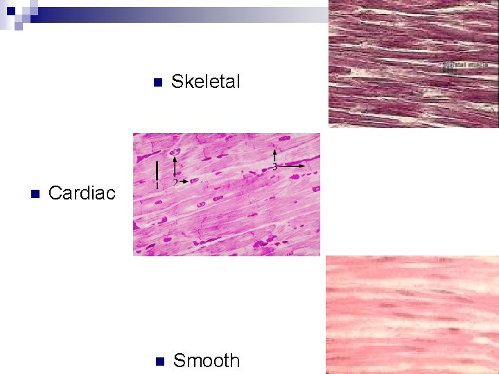 n n Skeletal n Smooth Cardiac 