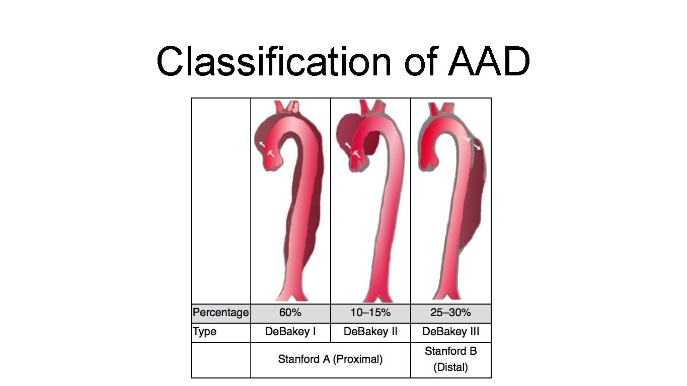 Classification of AAD 