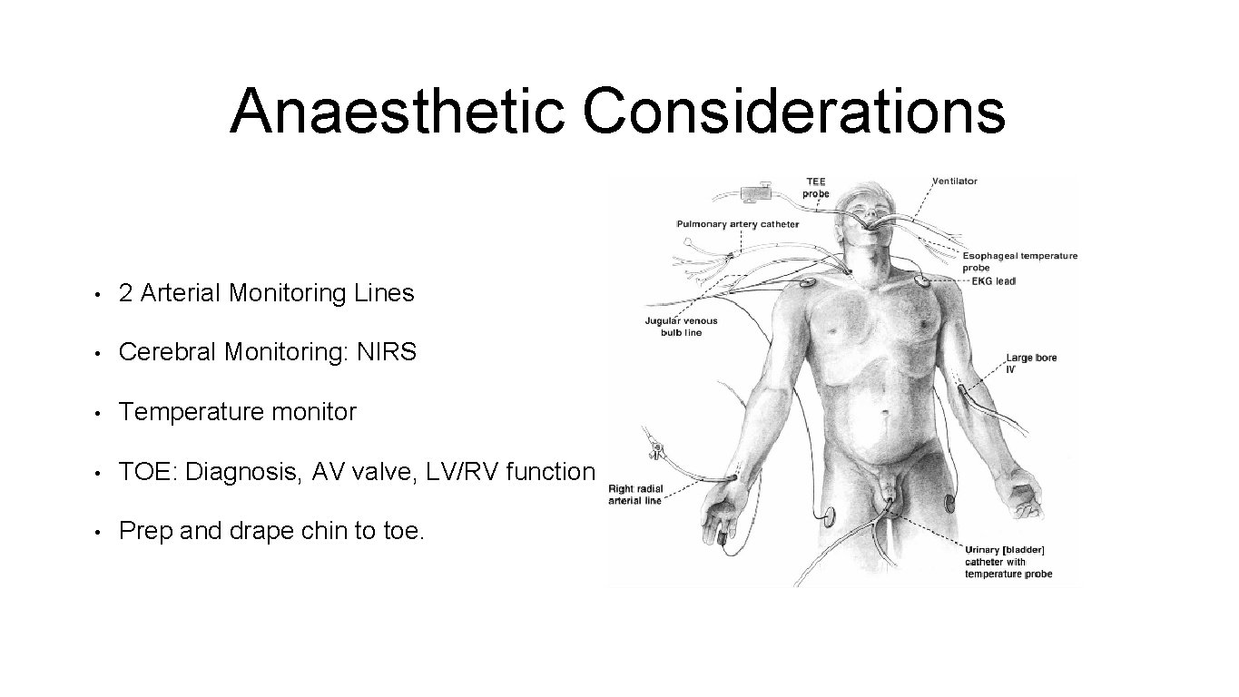 Anaesthetic Considerations • 2 Arterial Monitoring Lines • Cerebral Monitoring: NIRS • Temperature monitor