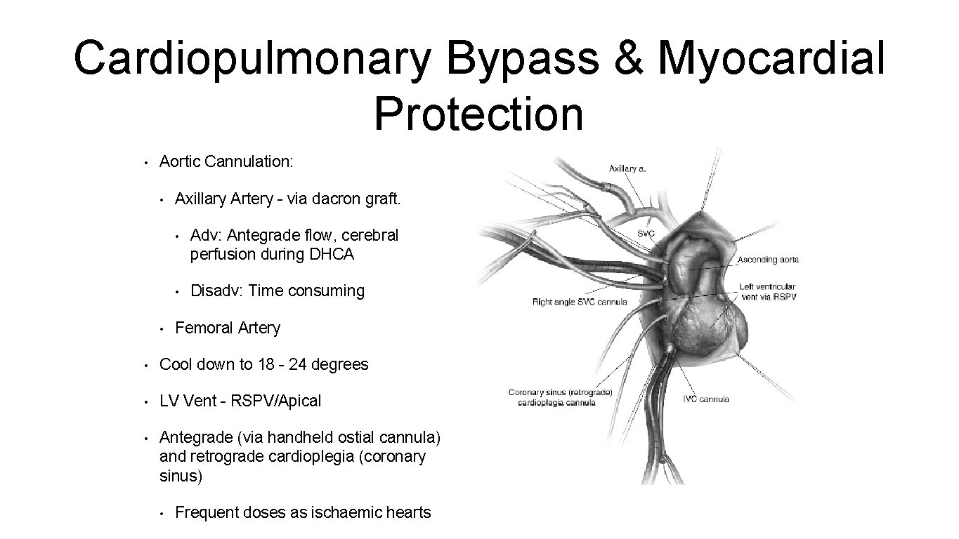 Cardiopulmonary Bypass & Myocardial Protection • Aortic Cannulation: • • Axillary Artery - via