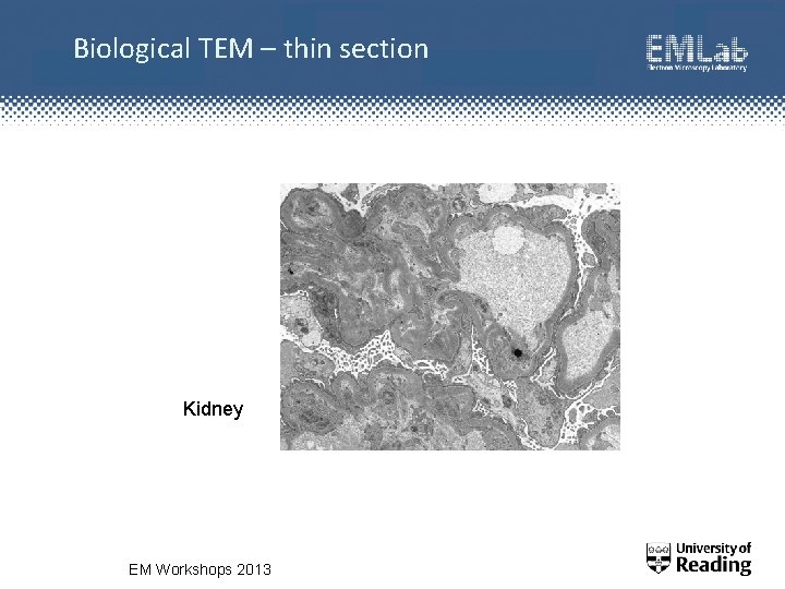 Biological TEM – thin section Kidney EM Workshops 2013 