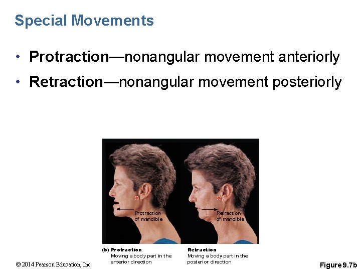 Special Movements • Protraction—nonangular movement anteriorly • Retraction—nonangular movement posteriorly Protraction of mandible ©