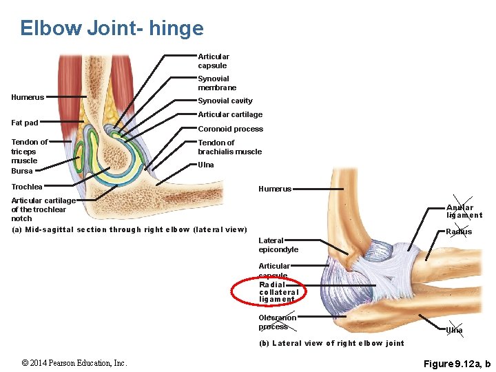 Elbow Joint- hinge Articular capsule Synovial membrane Humerus Fat pad Tendon of triceps muscle