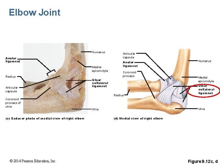 Elbow Joint Humerus Anular ligament Medial epicondyle Radius Articular capsule Anular ligament Coronoid process