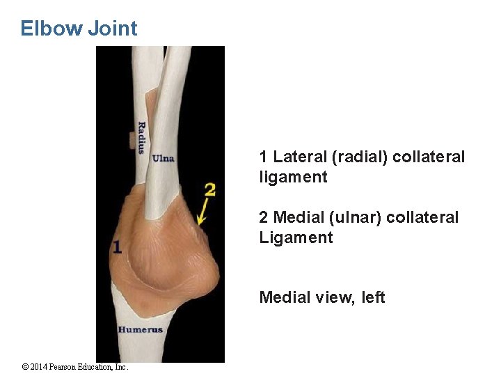 Elbow Joint 1 Lateral (radial) collateral ligament 2 Medial (ulnar) collateral Ligament Medial view,